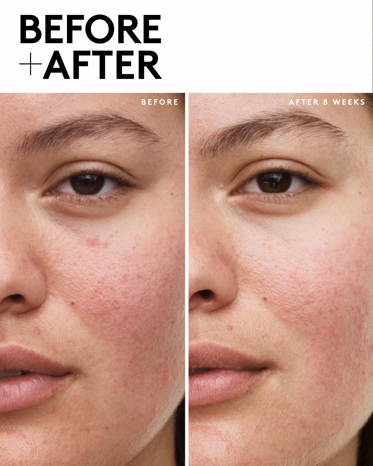 Fenty Skin Start’rs Full-Size Bundle: Dry Skin Edition