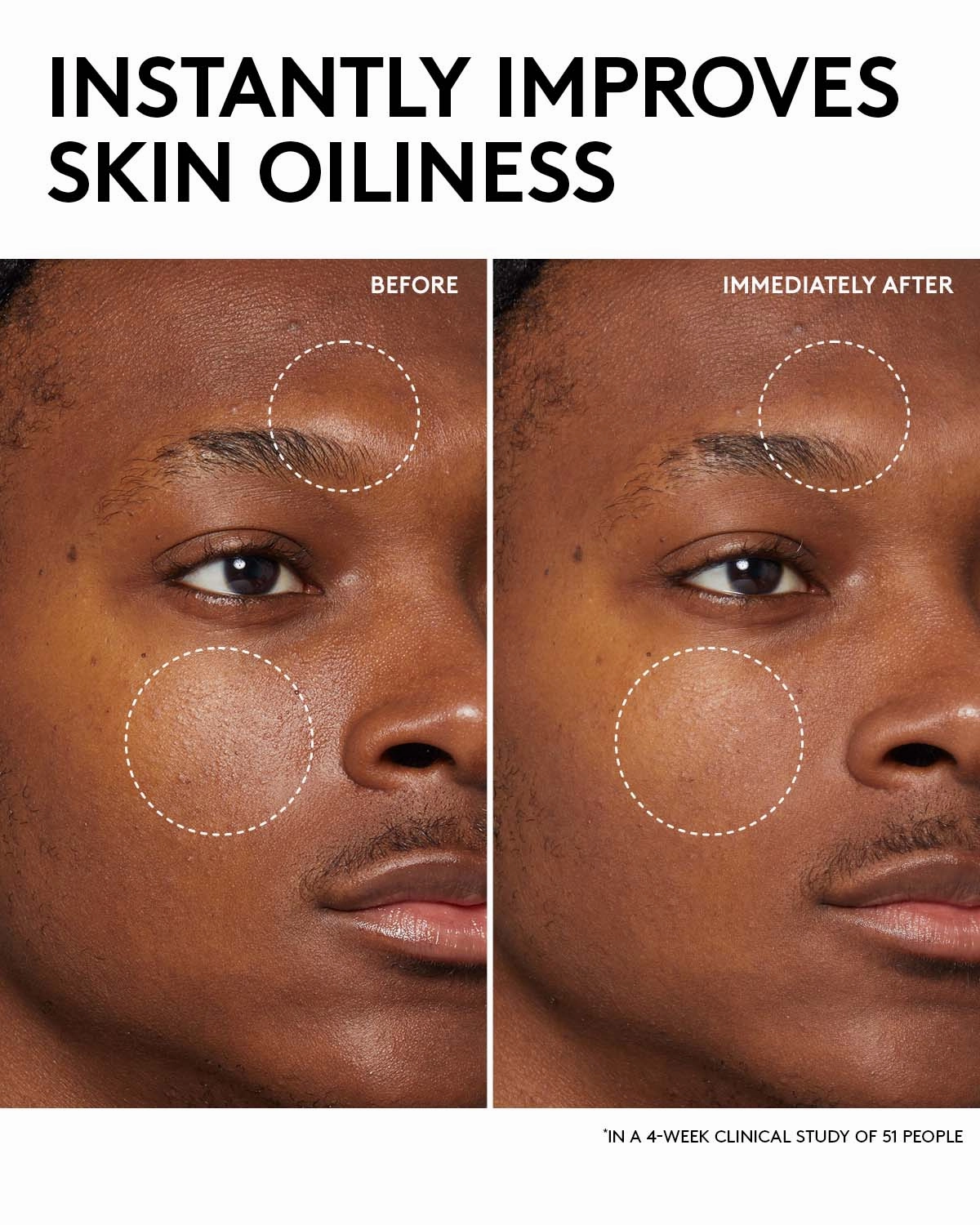 Fenty Skin Start’rs Full-Size Bundle: Oily Skin Edition