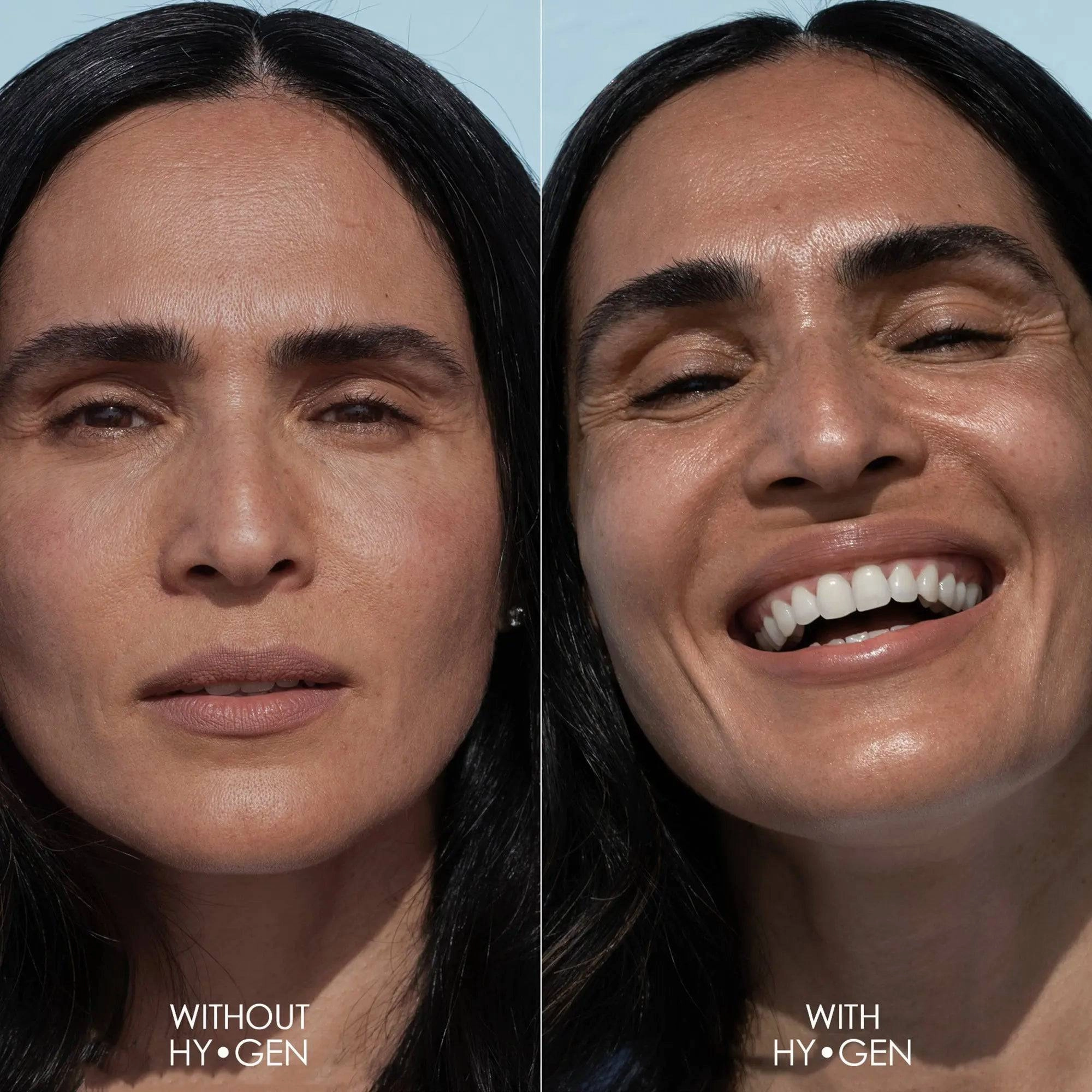 HY-GEN PRIMER SERUM