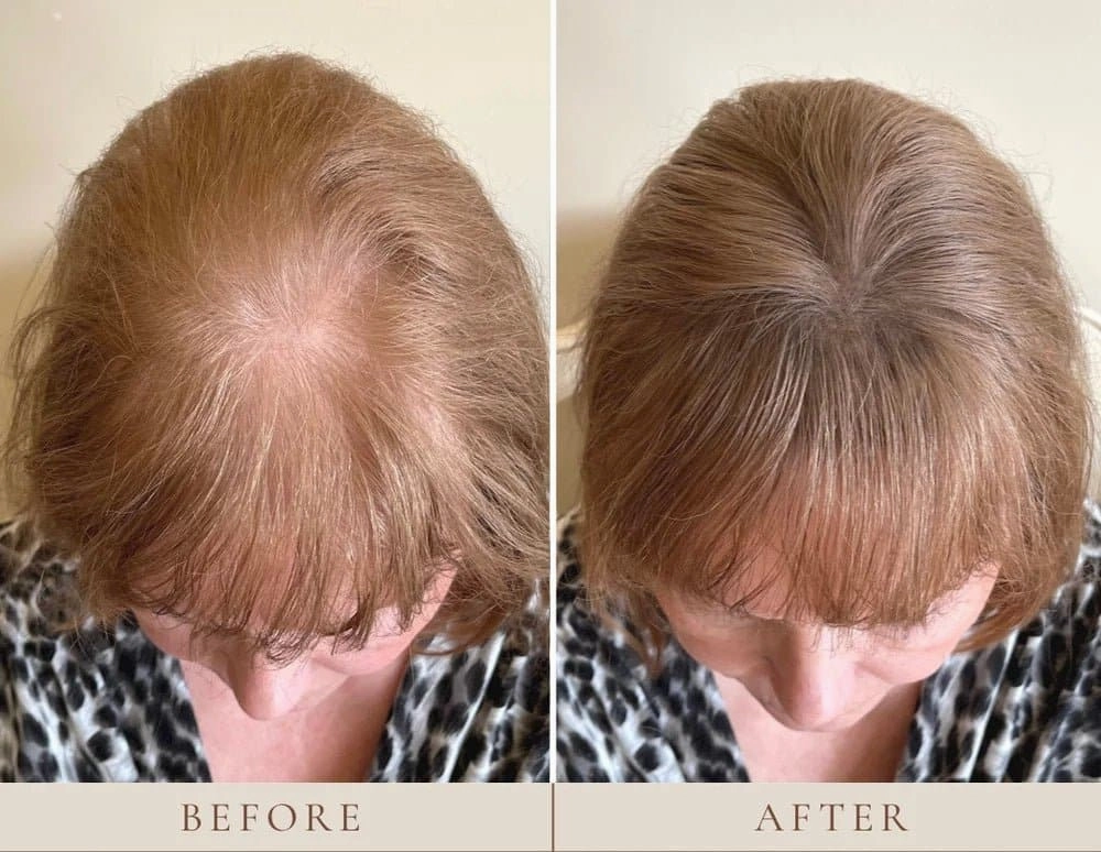 Instant Hairline Scalp Stick