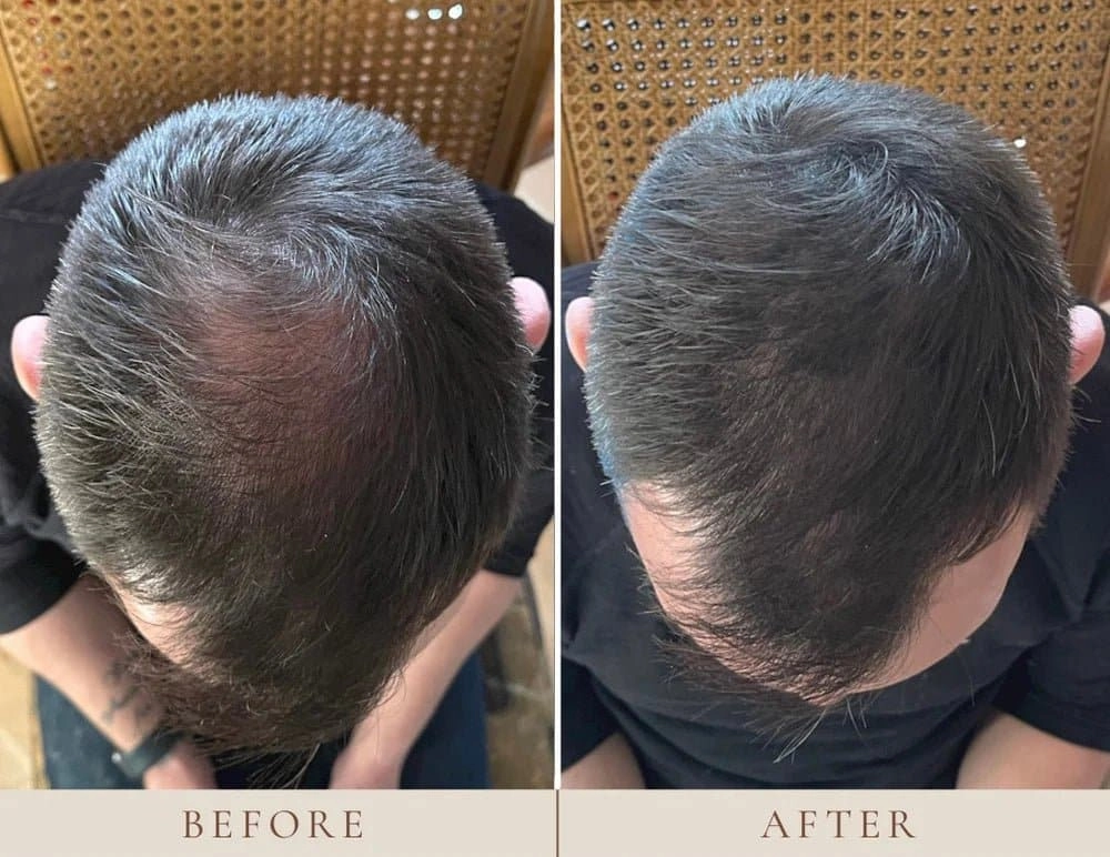 Instant Hairline Scalp Stick