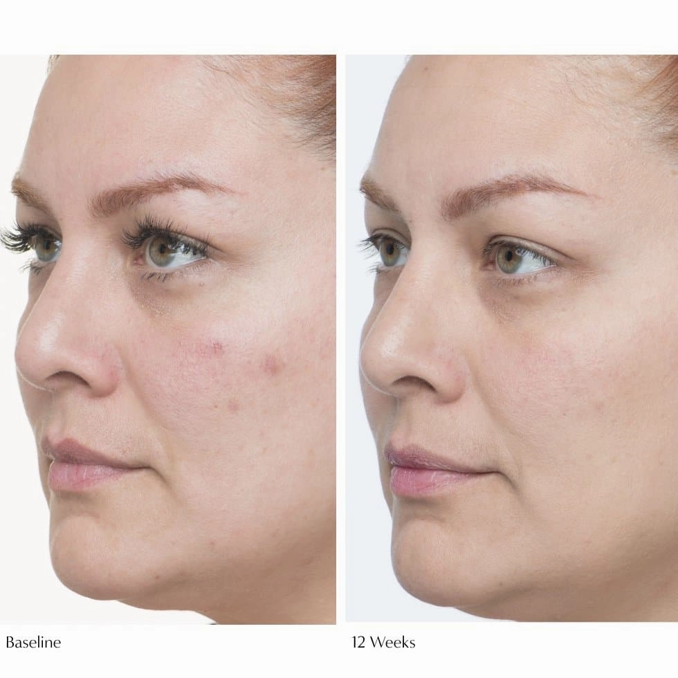 Plumscreen SPF 31