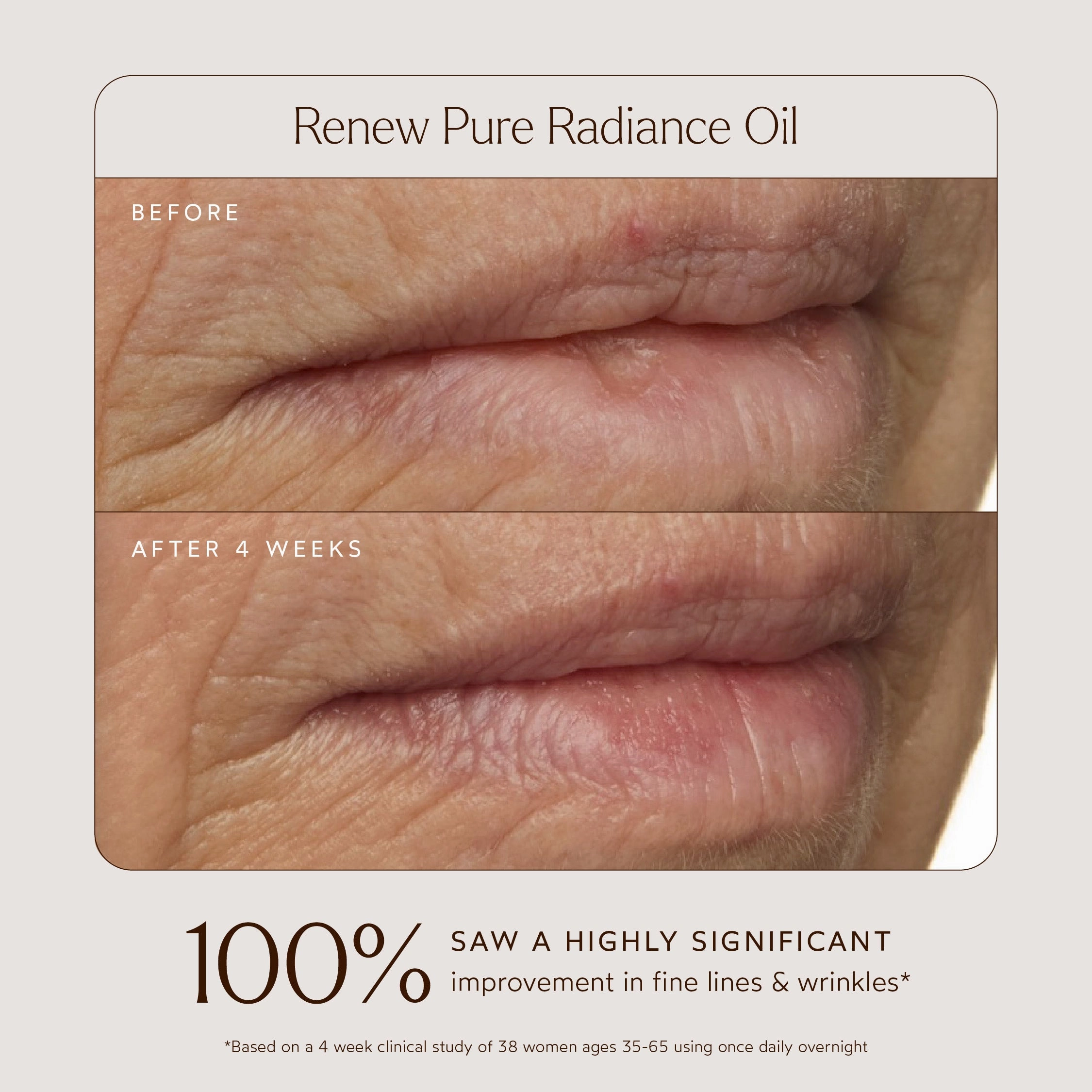 Pure Radiance Overnight Lip Treatment