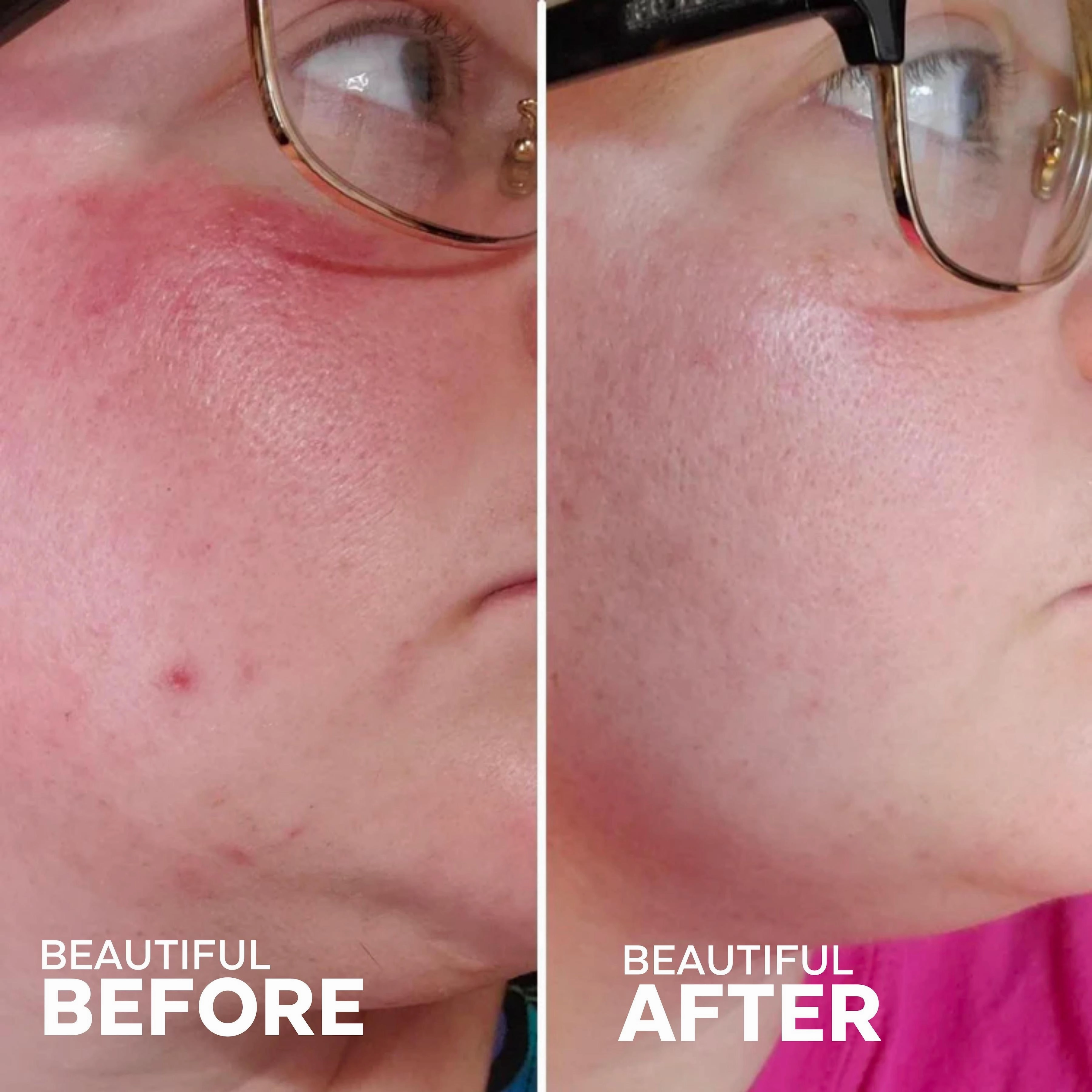 Radiance Grape Stem Cell   Squalane Day Cream