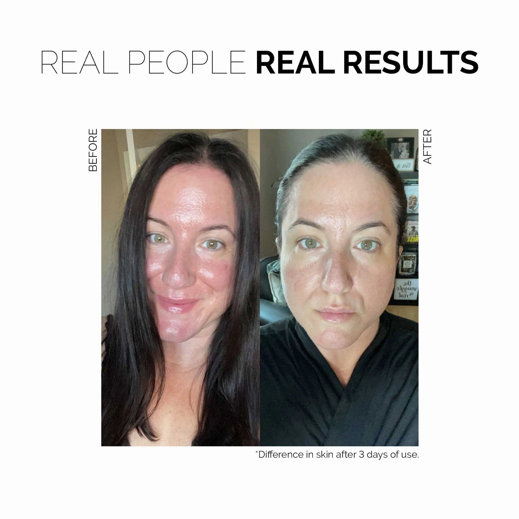 Redness Rescue Cream