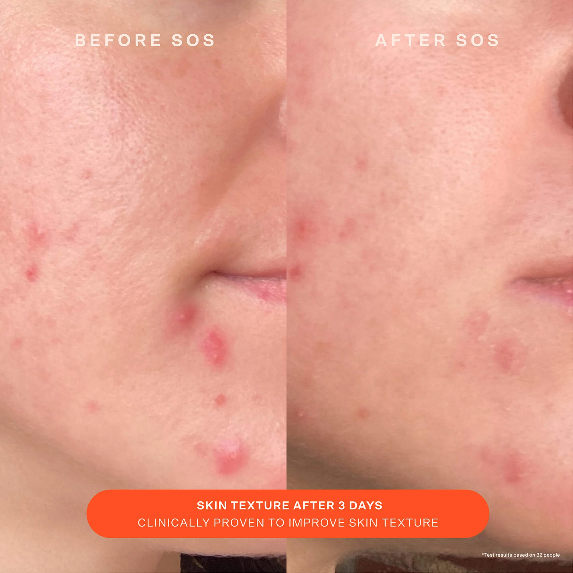 Travel SOS Recovery Cream